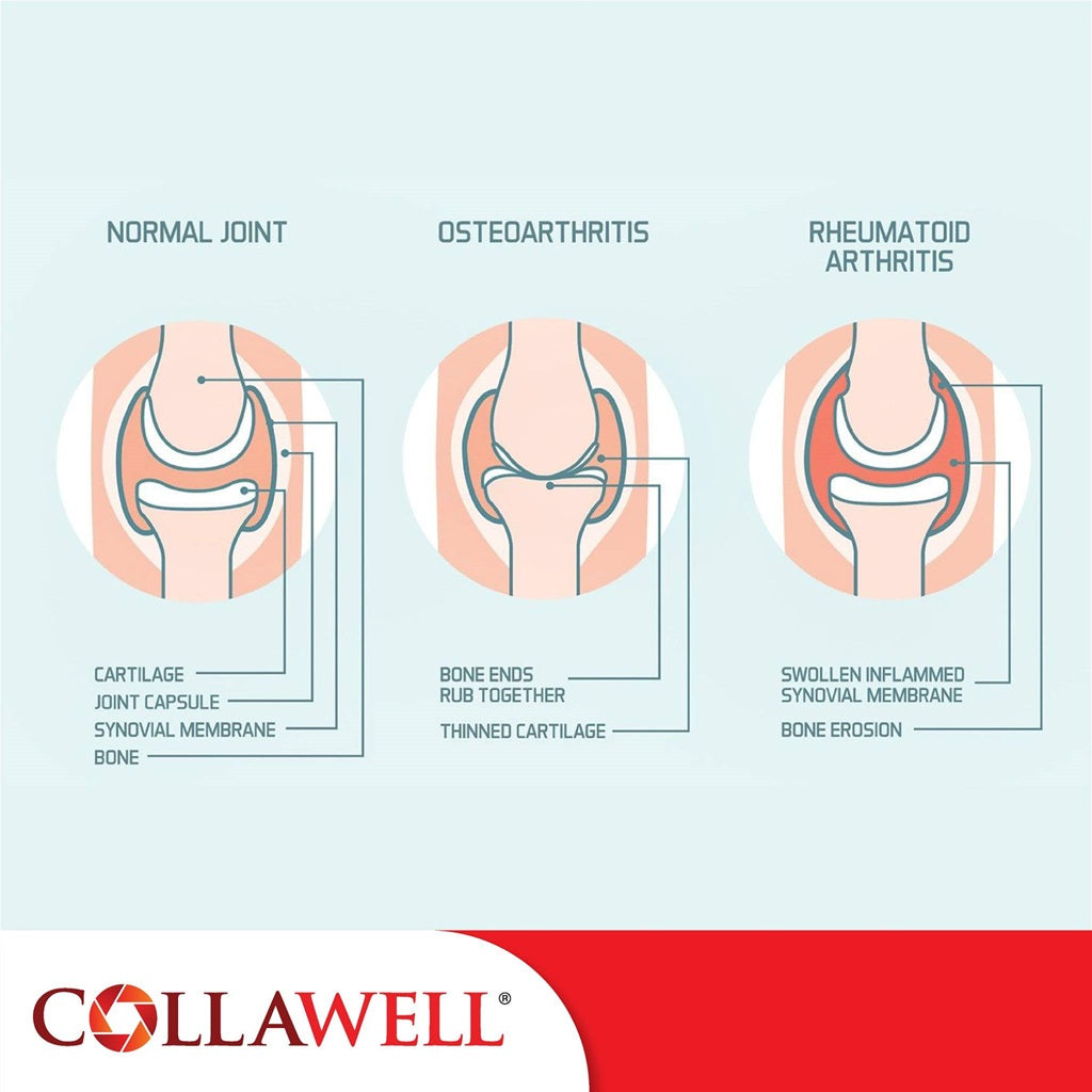 Collawell Collagen Complex Plus Powder (6g x 30 sachets)