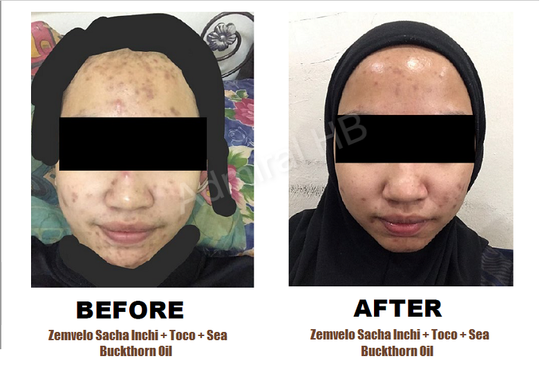 Zemvelo Sacha Inchi Oil + Tocotrienols + Sea Buckthorn Oil 520mg (2 x 60 vegetable softgels)