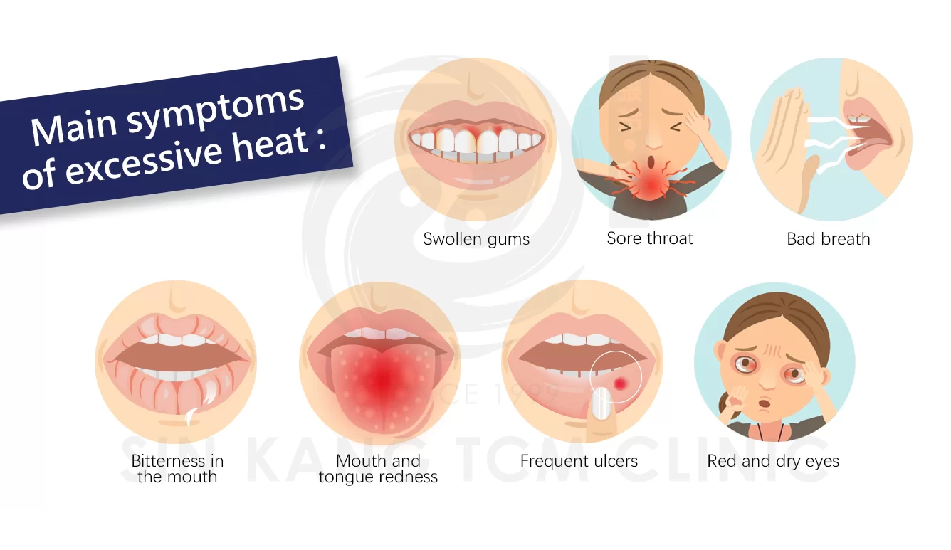 Green Heron HC Capsule 465mg (100 capsules) 清热